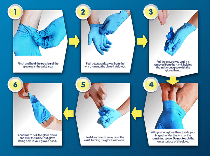 Cách tháo găng tay y tế tiệt trùng đúng chuẩn (Nguồn: Internet)