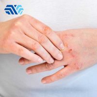 Tác Động Của Hóa Chất Lên Da Tay Và Cách Bảo Vệ Hiệu Quả Nhất